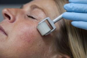 Mesotherapy Treatment, Mumbai – Skin Rejuvenation, Hair Regrowth