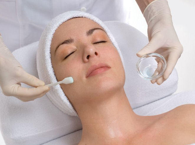 chemical-peels-chemical-peeling-skin-peeling-treatment