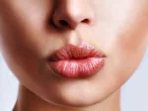 Lip fillers in Mumbai