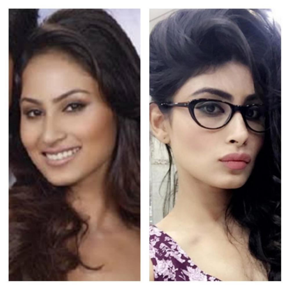 Mouni Roy Before After Plastic Surgery Makeover - Dr Niketa Sonavane