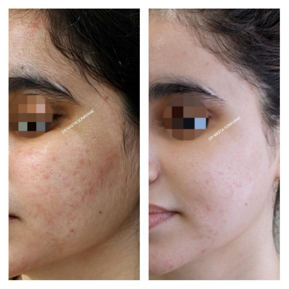 Celebrity Dermatologist In Mumbai, India