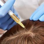 prp hair treatment in mumbai