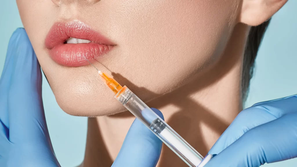 lip filler injections mumbai, lip filler mumbai, dermal filler mumbai, lip filler cose, best dermatologist in mumbai, Dr Niketa Sonavane, lip injections, lip filler injections,